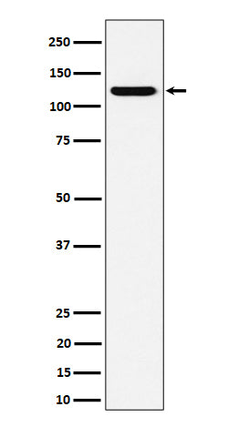 Western blot analysis of PKN2 expression in HeLa cell lysate.