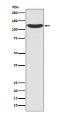 Western blot analysis of PKN2 in 293T cell lysate.