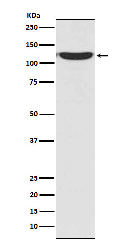 Western blot analysis of PKN2 in 293T cell lysate.