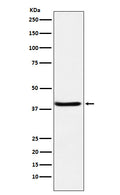 Western blot analysis of SerpinB3 expression in A431 cell lysate.