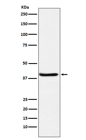 Western blot analysis of SerpinB3 expression in A431 cell lysate.