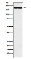 Western blot analysis of MRC2/ENDO180 expression in Saos2 cell lysate.