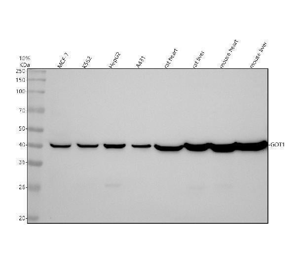 Anti-Aspartate Aminotransferase Monoclonal Antibody