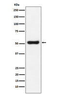 Western blot analysis of OLFM4 expression in LnCaP cell lysate.