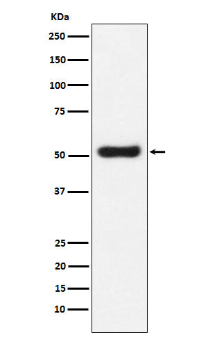 Western blot analysis of OLFM4 expression in LnCaP cell lysate.