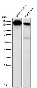 All lanes use the Antibody at 1:2K dilution for 1 hour at room temperature.