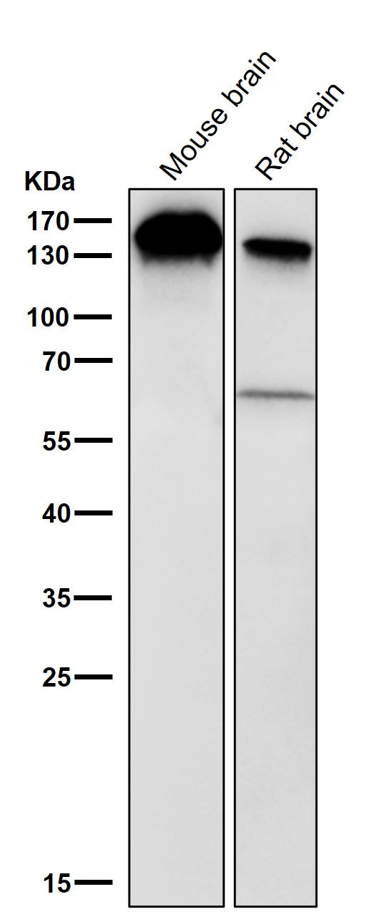 All lanes use the Antibody at 1:2K dilution for 1 hour at room temperature.