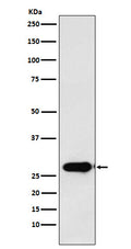Anti-Calpain S1 Rabbit Monoclonal Antibody