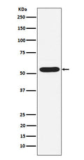 Western blot analysis of PIAS2 expression in HepG2 cell lysate.