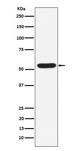 Western blot analysis of PIAS2 expression in HepG2 cell lysate.