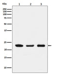 Western blot analysis of p23 expression in (1) HeLa cell lysate; (2) NIH/3T3 cell lysate; (3) PC12 cell lysate.