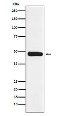 Western blot analysis of ERCC8 expression in Molt4 cell lysate.
