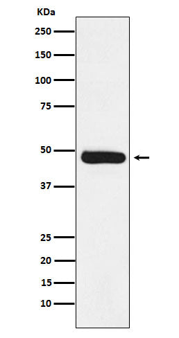 Western blot analysis of ERCC8 expression in Molt4 cell lysate.