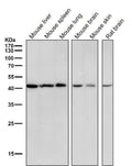 All lanes use the Antibody at 1:3K dilution for 1 hour at room temperature.