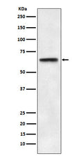 Western blot analysis of ABCE1 expression in HeLa cell lysate.