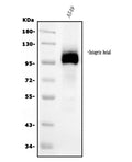 Anti-Integrin beta 5/ITGB5 Antibody Picoband® (monoclonal, 9E2)