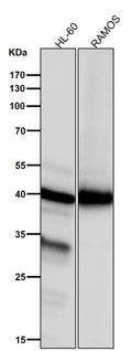 All lanes use the Antibody at 1:3K dilution for 1 hour at room temperature.