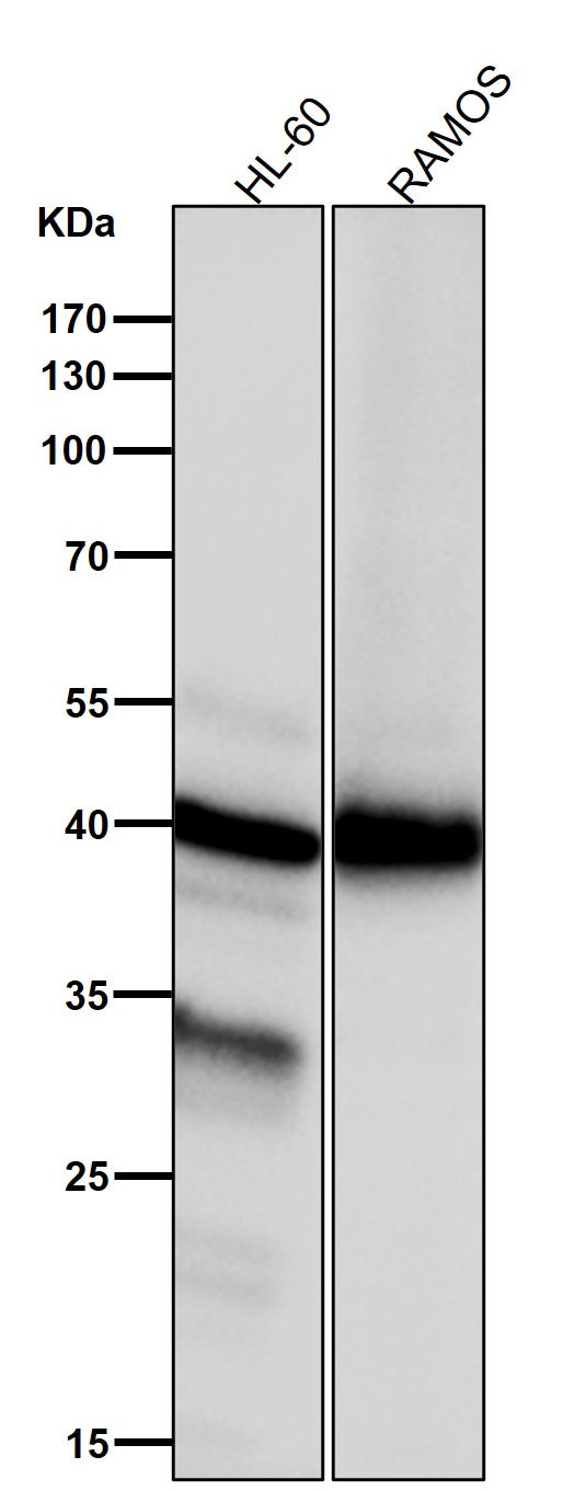 All lanes use the Antibody at 1:3K dilution for 1 hour at room temperature.