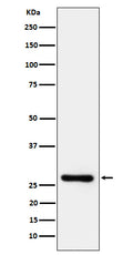 Western blot analysis of DcR1/CD263 expression in Jurkat cell lysate.