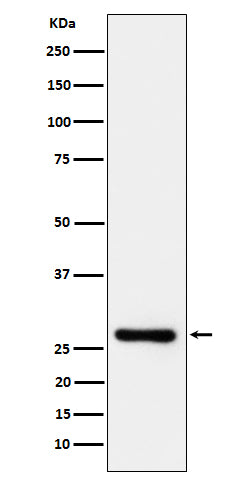 Western blot analysis of DcR1/CD263 expression in Jurkat cell lysate.