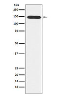 Western blot analysis of PLCB3 expression in A431 cell lysate.