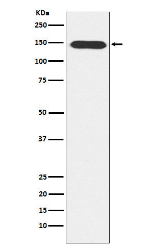 Western blot analysis of PLCB3 expression in A431 cell lysate.