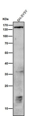 All lanes use the Antibody at 1:1K dilution for 1 hour at room temperature.