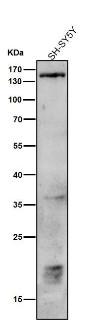 All lanes use the Antibody at 1:1K dilution for 1 hour at room temperature.