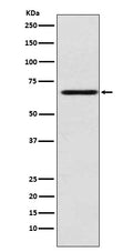 Western blot analysis of MADCAM1 expression in HUVEC cell lysate.
