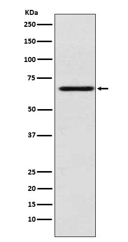 Western blot analysis of MADCAM1 expression in HUVEC cell lysate.