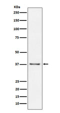 Western blot analysis of CD23 expression in Raji cell lysate.
