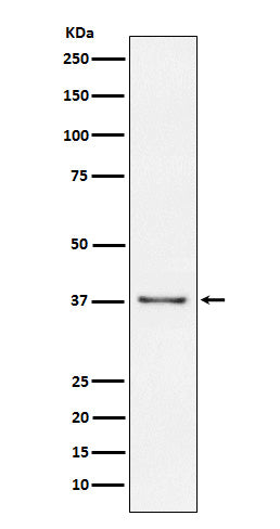 Western blot analysis of CD23 expression in Raji cell lysate.