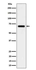 Western blot analysis of CD125 in Human serum cell lysate.