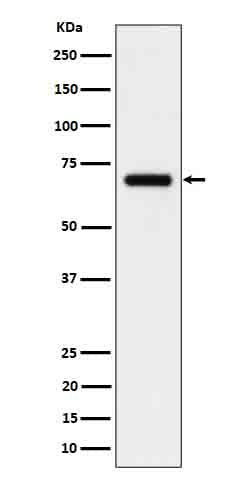 Western blot analysis of CD125 in Human serum cell lysate.