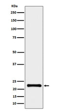 Anti-CRCP Rabbit Monoclonal Antibody