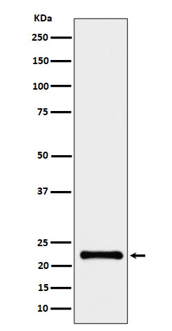 Anti-CRCP Rabbit Monoclonal Antibody