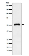 Western blot analysis of Retinoic Acid Receptor gamma expression in HeLa cell lysate.