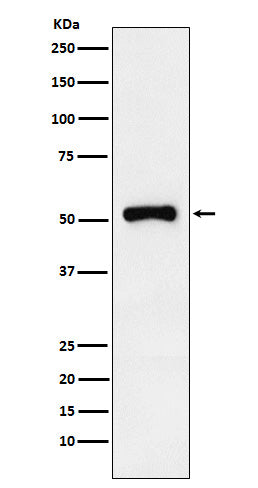 Western blot analysis of Retinoic Acid Receptor gamma expression in HeLa cell lysate.