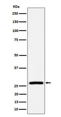 Western blot analysis of AK2 expression in HepG2 cell lysate.