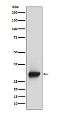 Western blot analysis of Calretinin expression in SH-SY5Y cell lysate.