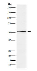 Western blot analysis of MEIS2 expression in HepG2 cell lysate.