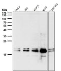 All lanes use the Antibody at 1:5K dilution for 1 hour at room temperature.