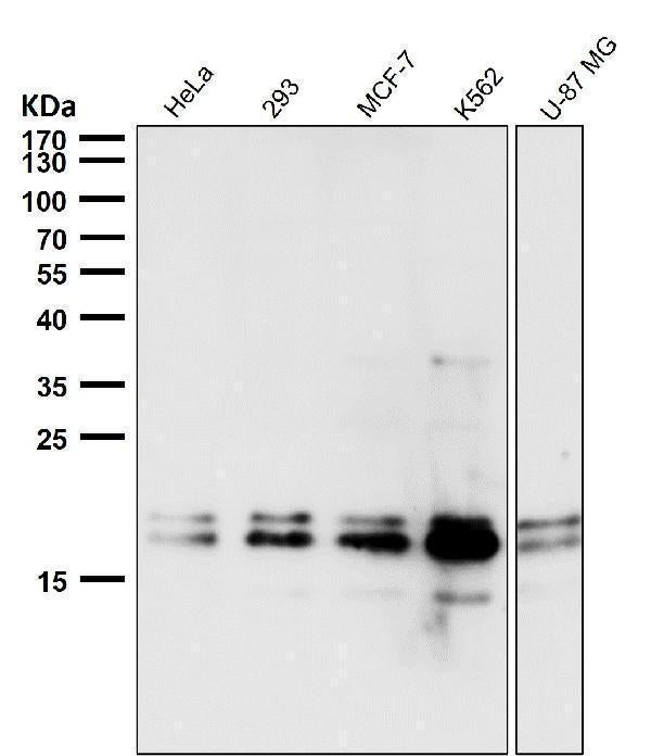 All lanes use the Antibody at 1:5K dilution for 1 hour at room temperature.