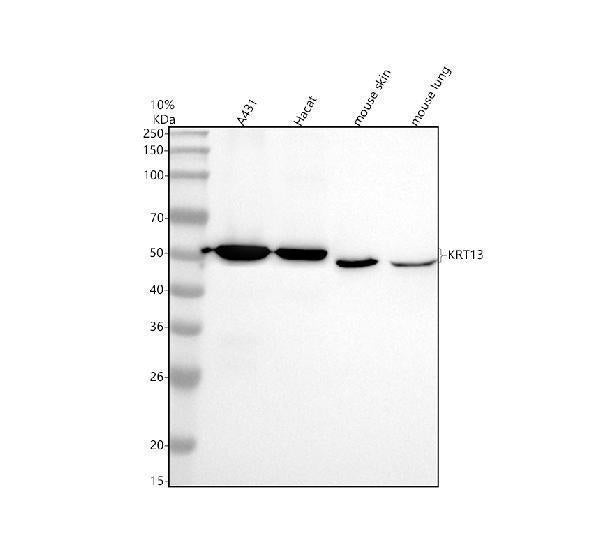 Anti-Cytokeratin 13 Rabbit Monoclonal Antibody