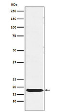 Western blot analysis of TSH beta expression in Human pituitary lysate.