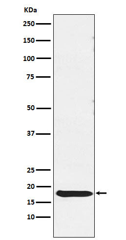 Western blot analysis of TSH beta expression in Human pituitary lysate.