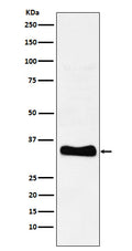Western blot analysis of Monoacylglycerol Lipase expression in human heart lysate.