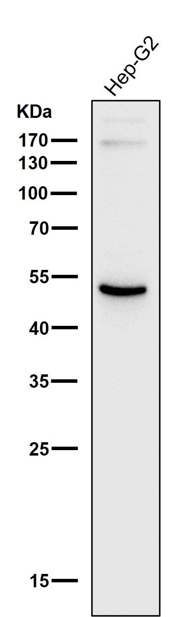 All lanes use the Antibody at 1:1K dilution for 1 hour at room temperature.