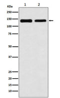 Western blot analysis of UBE4B expression in (1) 293T cell lysate; (2) NIH/3T3 cell lysate.