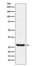 Western blot analysis of Sprouty 4 expression in MCF7 cell lysate.